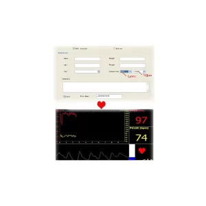 Pulsioxímetro de muñeca CMS 50F