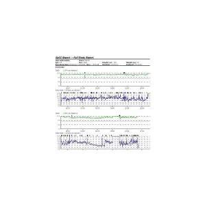 Pulsioxímetro de muñeca CMS 50F