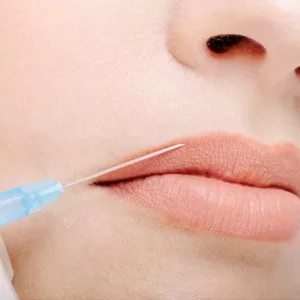 Las cremas de ácido hialurónico en labios