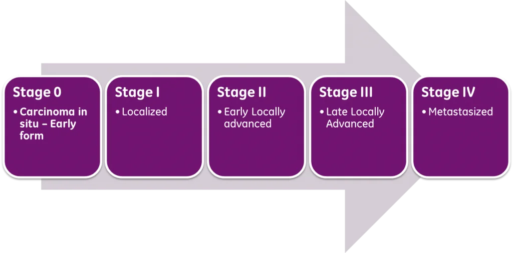 Staging bladder cancer using the TNM system